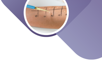 Острые аллергические реакции у детей.