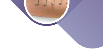 Острые аллергические реакции у детей.