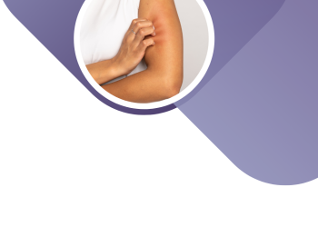 Первичный билиарный холангит. Чем мы можем помочь пациенту в настоящее время?